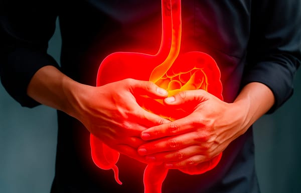 Diverticulitis Flare Up